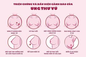 Một số tác dụng phụ của xạ trị ung thư vú